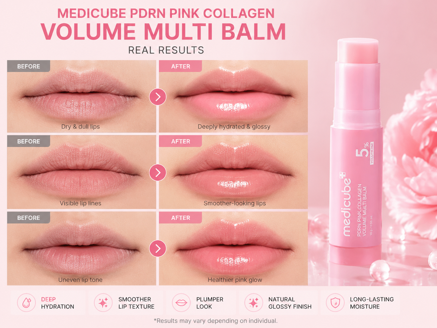 Veloura Lips™ — Silky smooth collagen care