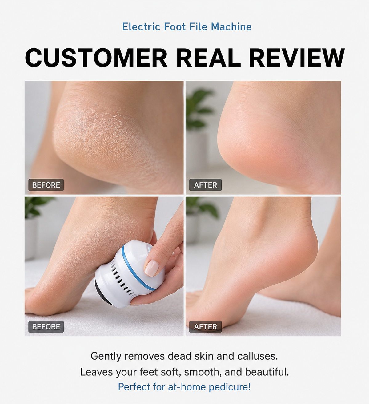 HeelNova™ Removes calluses effortlessly.