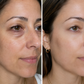 Eye Revival™ — Targeted Care for Puffiness & Dark Circles