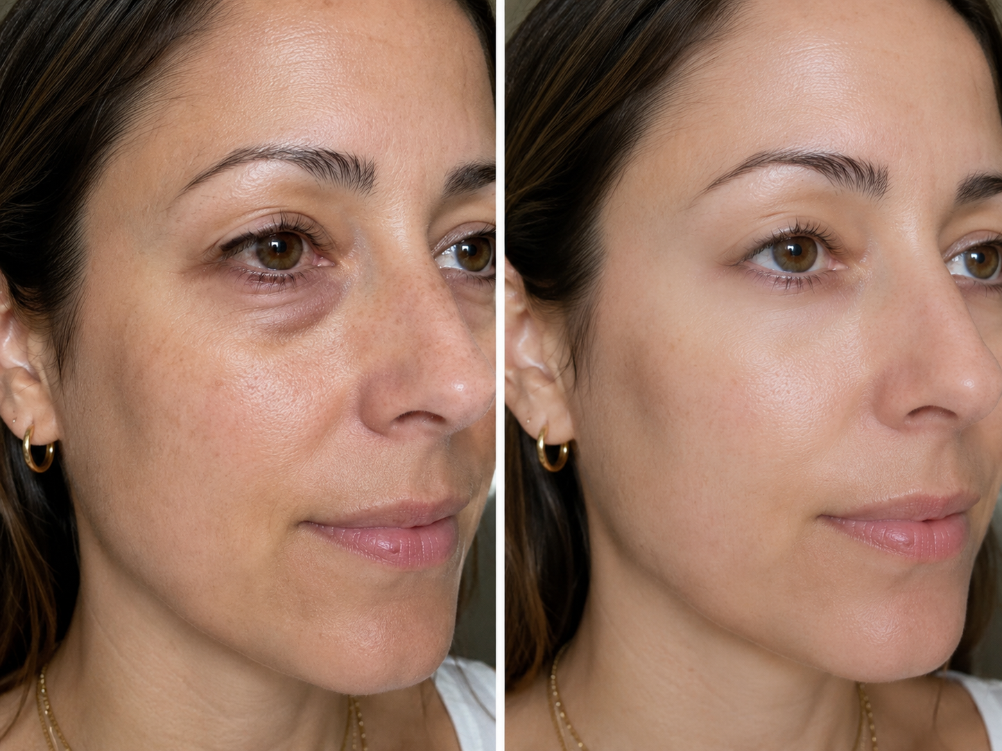 Eye Revival™ — Targeted Care for Puffiness & Dark Circles