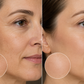 AgeRenew™ — Targeted Care for Fine Lines & Wrinkles.