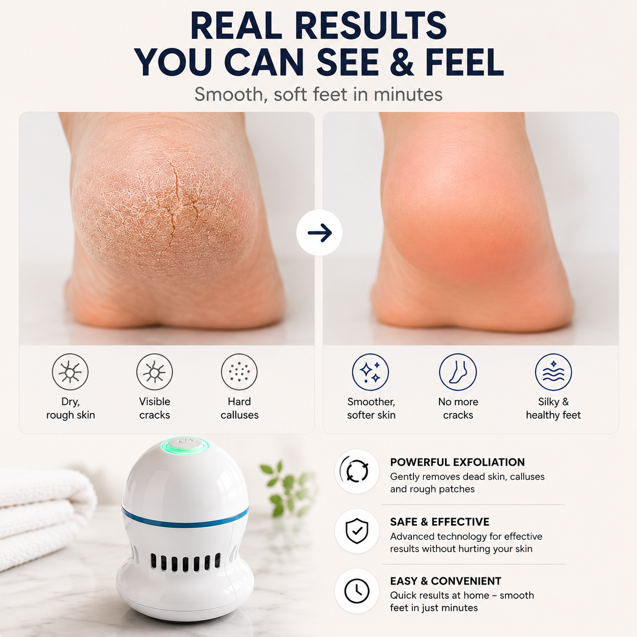 HeelNova™ Removes calluses effortlessly.